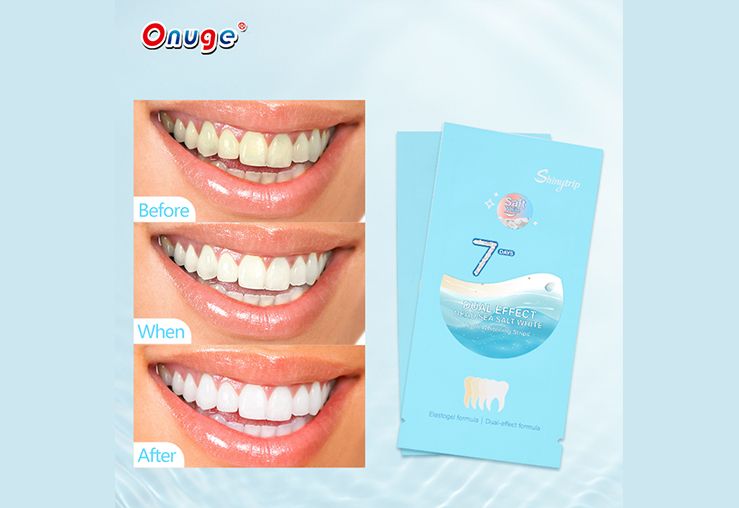 Do Whitening Strips Work? Effectiveness, Results & Precautions